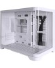 1STPLAYER UVIEW UV6 (UV6-BK)